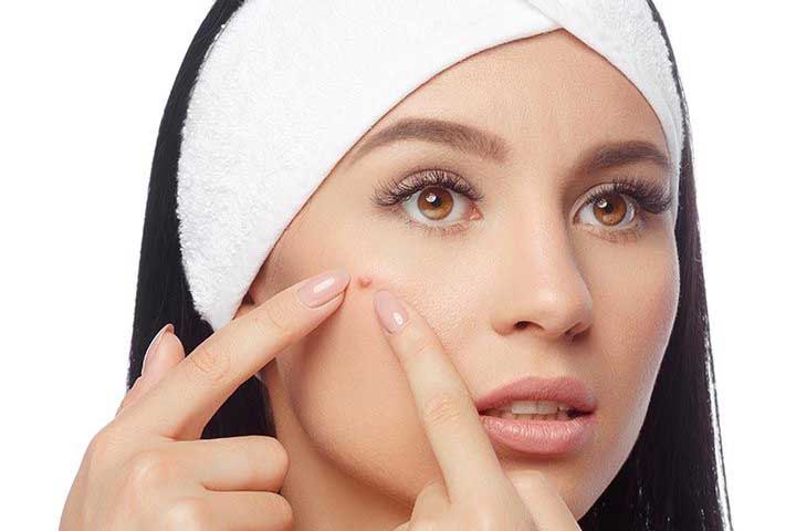 نقشهبرداری صورت در تشخیص جوش + علل بروز جوش | لیلی بیوتی