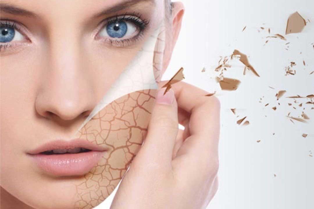 ضدچروک برای پوست خشک