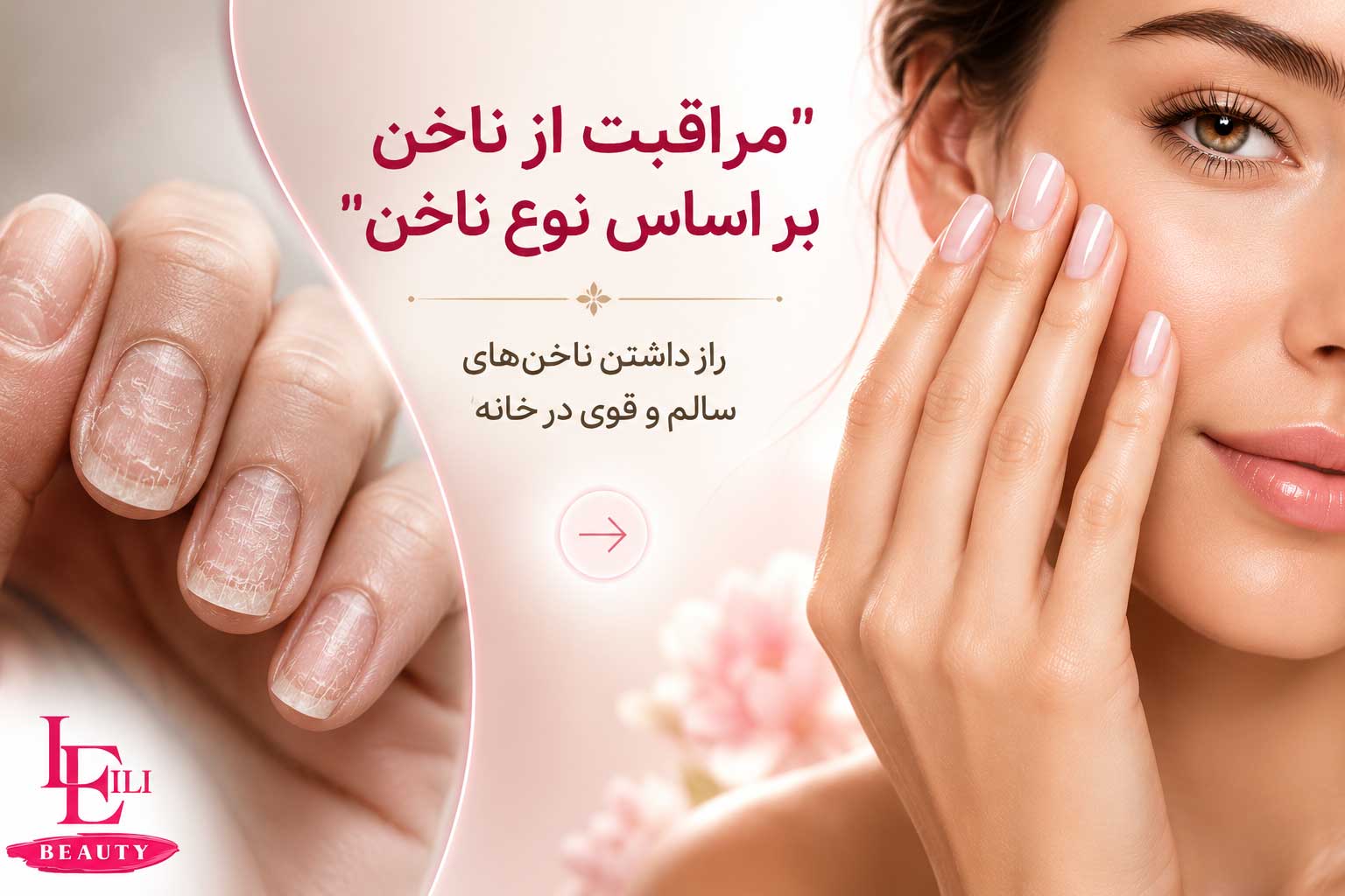 مراقبت از ناخن بر اساس نوع ناخن