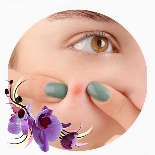 جوش و آکنه | اوریفلیم، آون و پیر کاردین