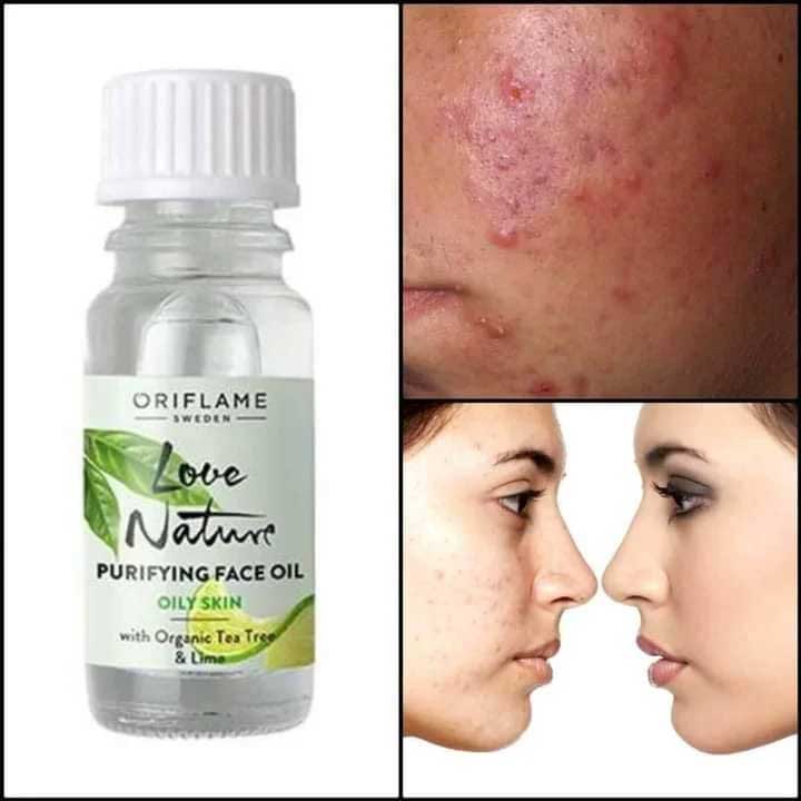 روغن تی تری و لیمو لاونیچر اوریفلیم روغن تی تری و لیمو لاونیچر اوریفلیم