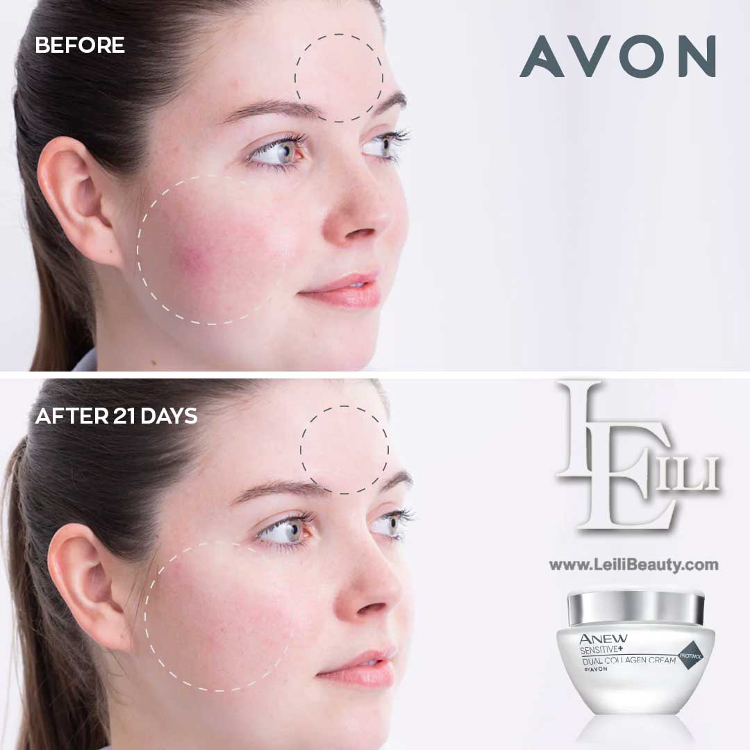 خرید کرم کلاژن ساز دوگانه صورت حساس آنیو سنسیتیو آون از لیلی بیوتی