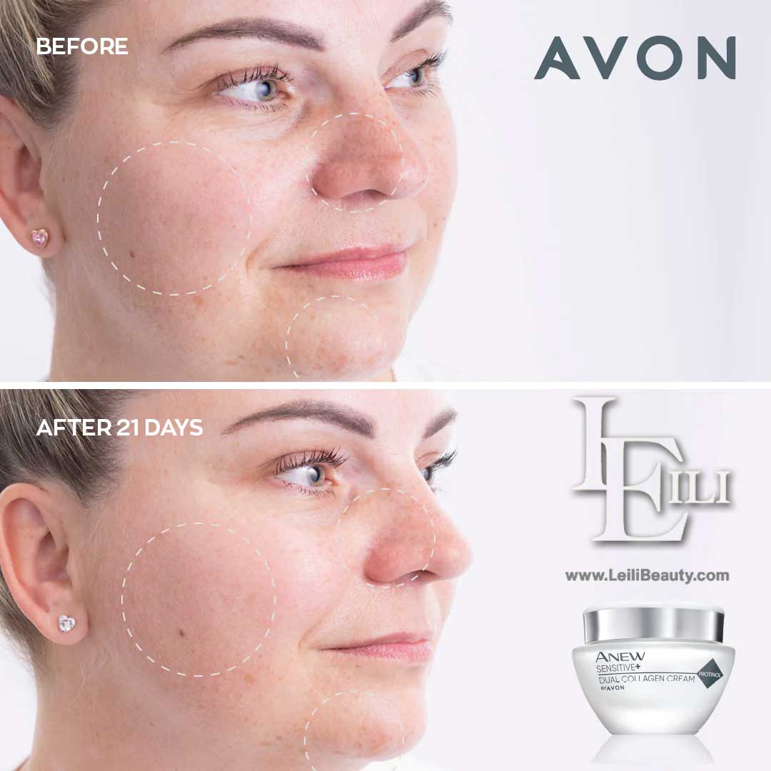 خرید کرم کلاژن ساز دوگانه صورت حساس آنیو سنسیتیو آون از لیلی بیوتی