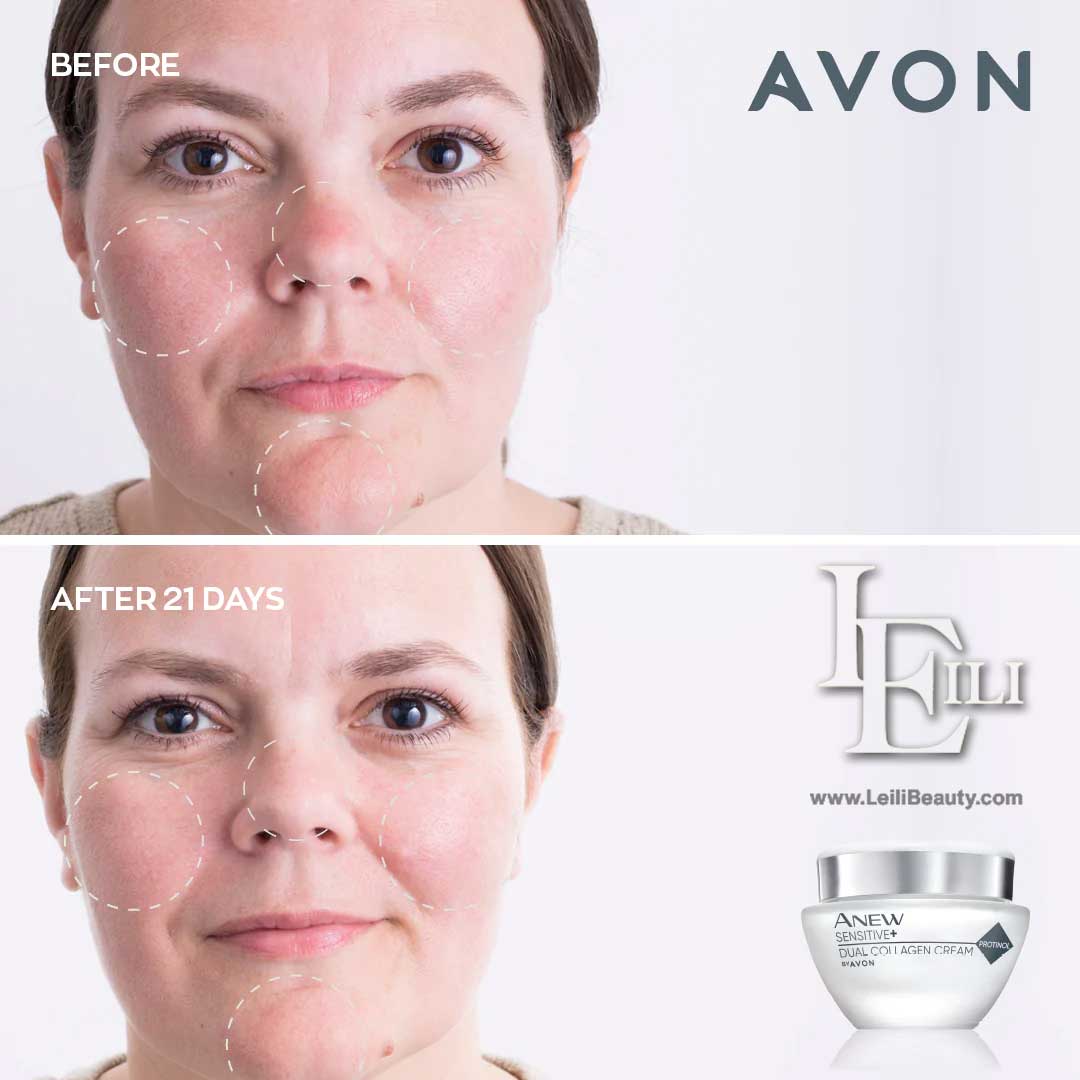 Anew Sensitive+ Dual Collagen Cream avon