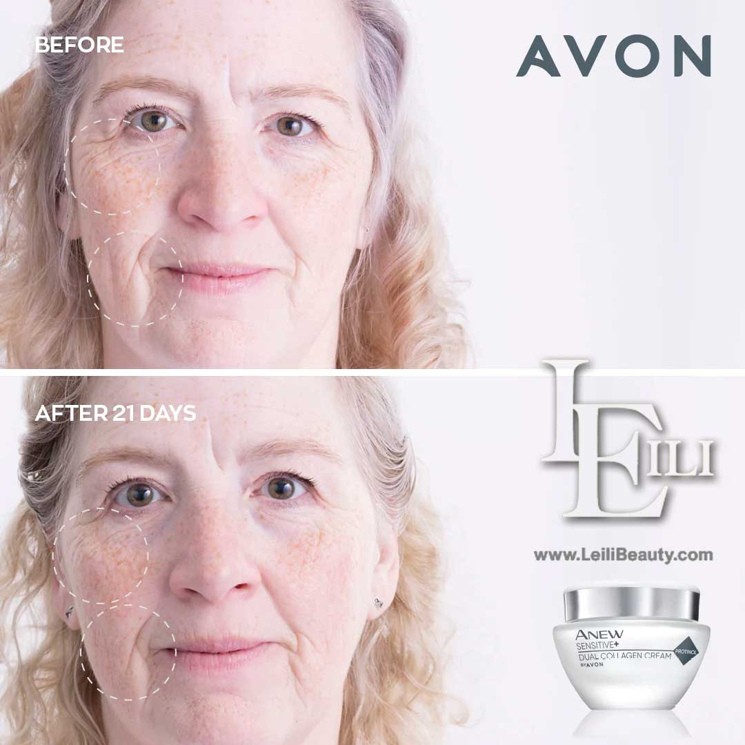 کرم کلاژن ساز دوگانه پوست حساس آنیو سنسیتیو آون